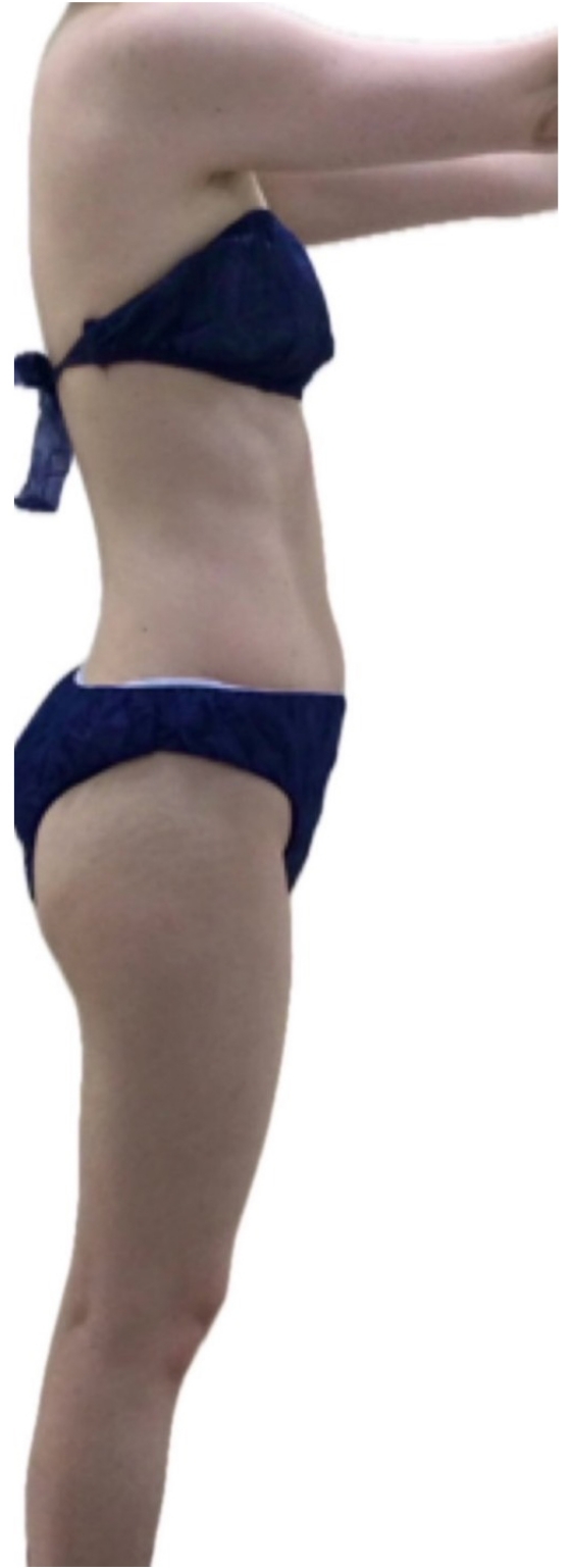 お腹集中痩せコース