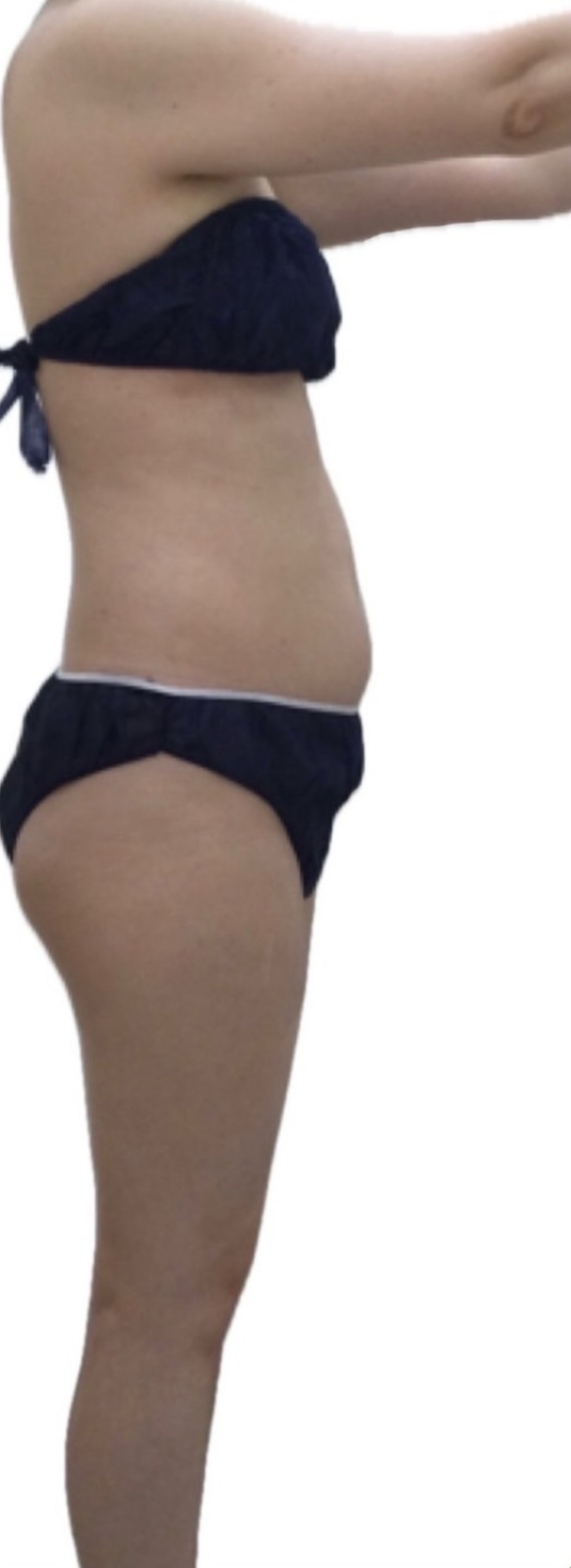 お腹集中痩せコース