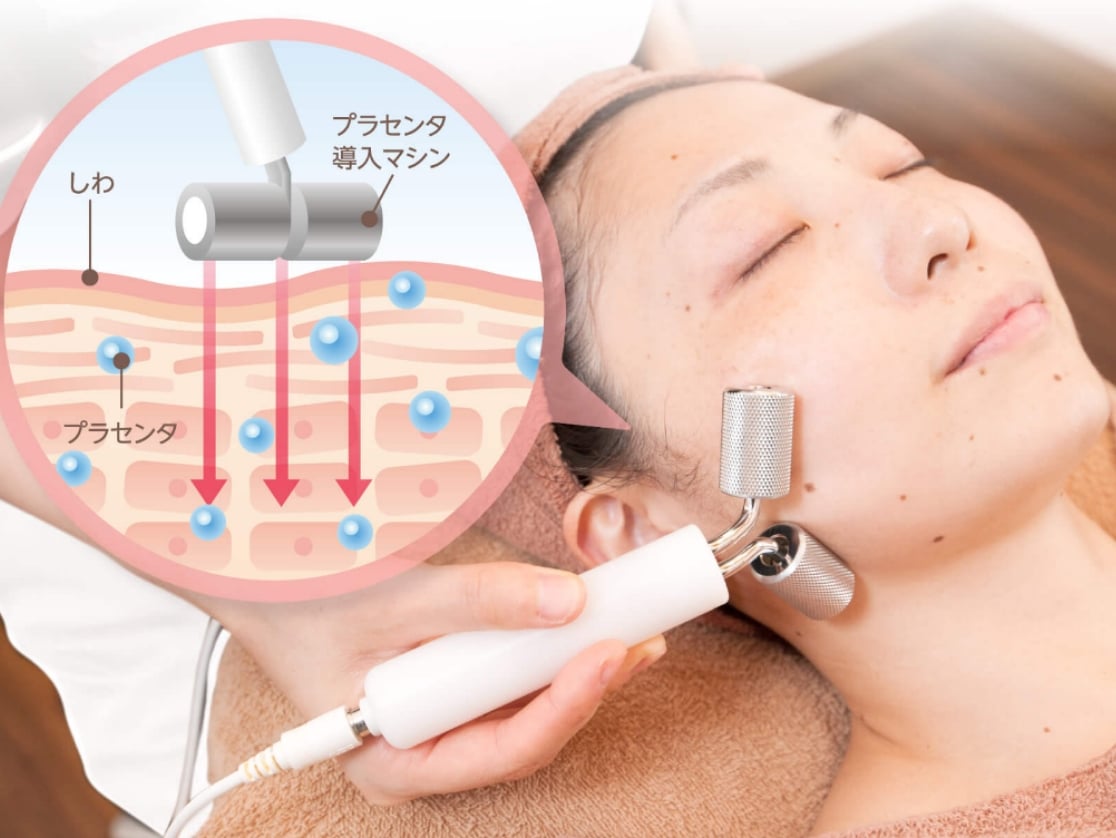 プラセンタをたっぷり補給