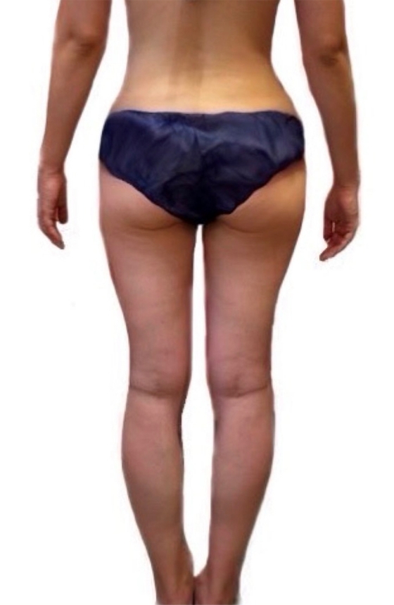 下半身集中痩せコース