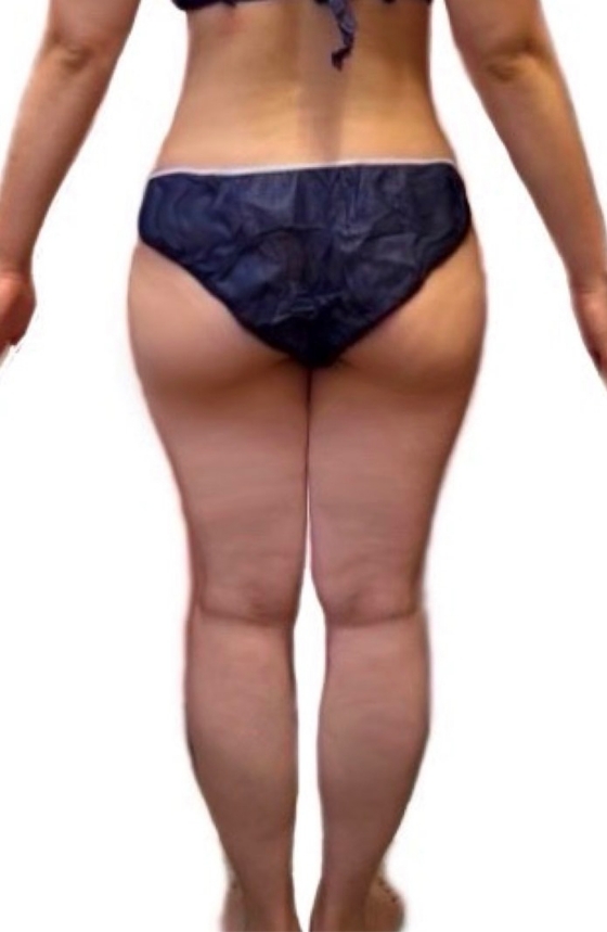 下半身集中痩せコース