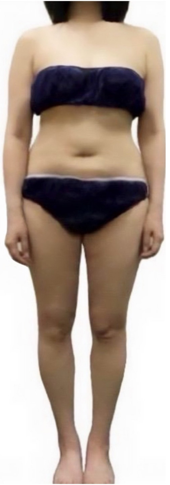 即効スリムコース