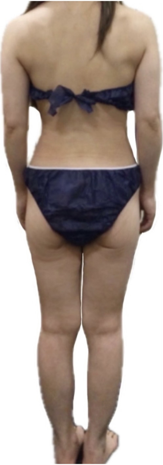 即効スリムコース