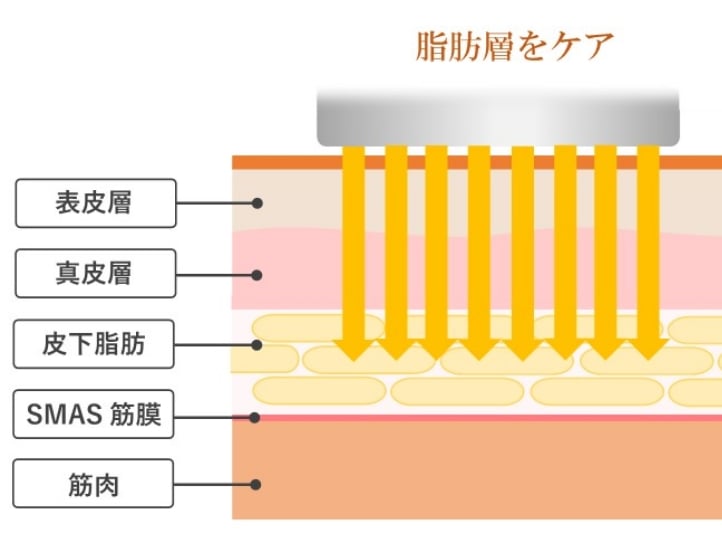 まんべんなく脂肪をすっきりケア