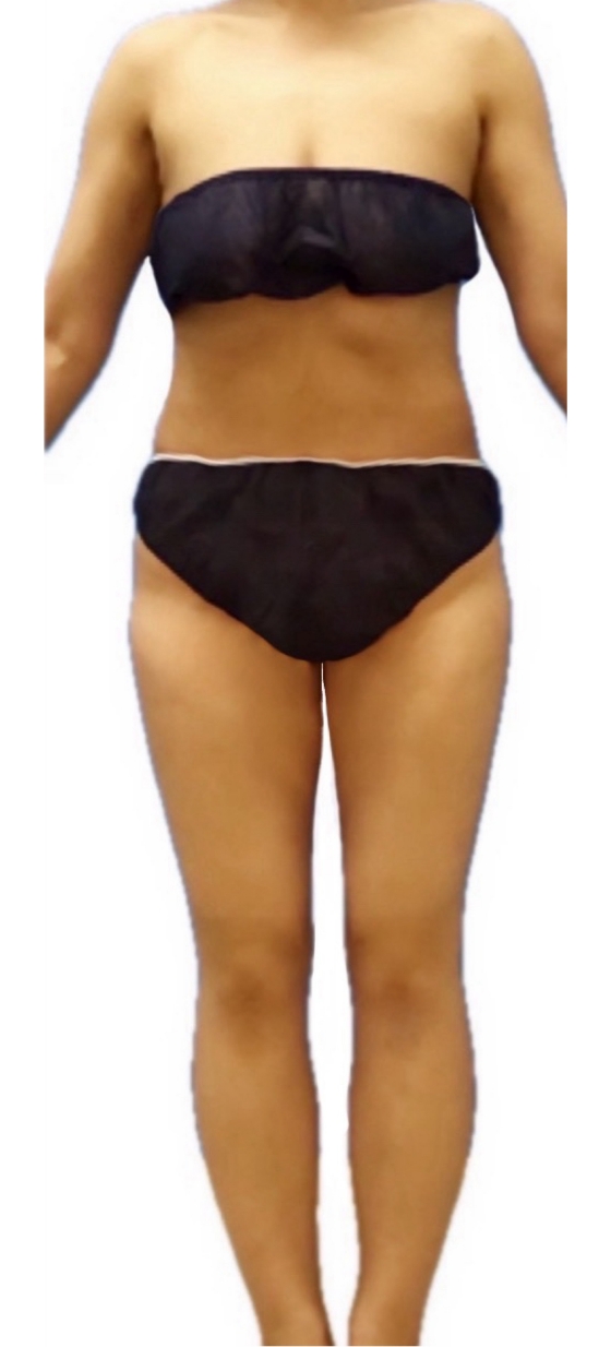 ウルトラ大幅スリムコース