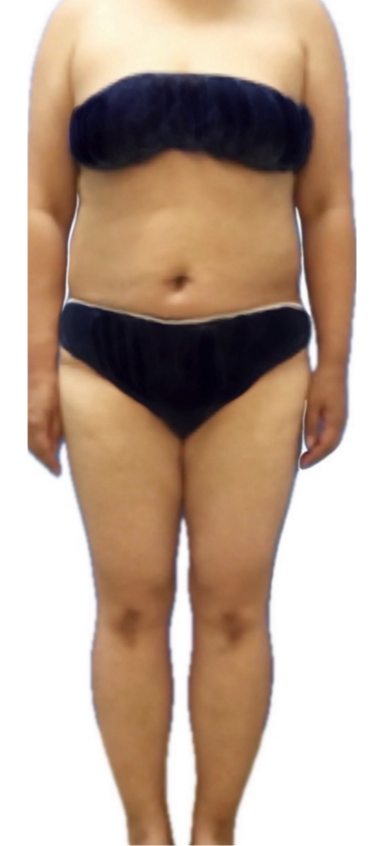 ウルトラ大幅スリムコース