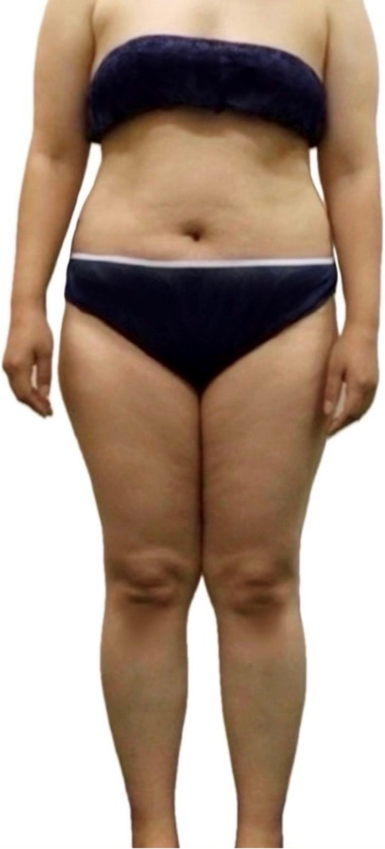 ウルトラ大幅スリムコース